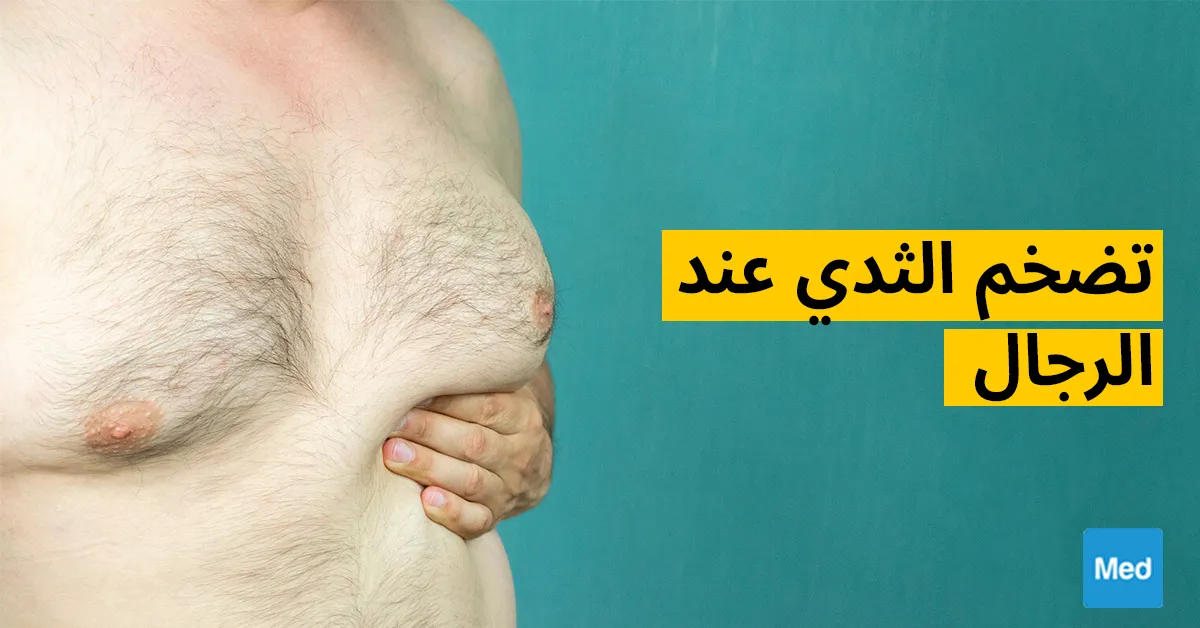 تضخم الثدي عند الرجال